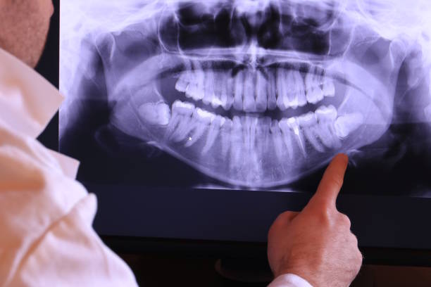 Best Orthodontic Emergency Dentist in St Louis, MI