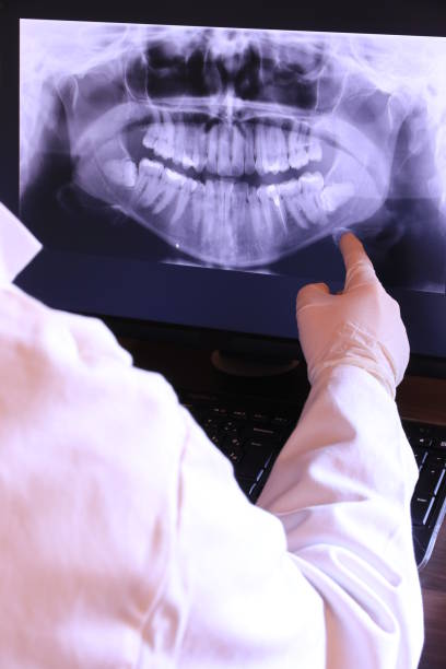 Best Urgent Dental Care for Toothache in St Louis, MI