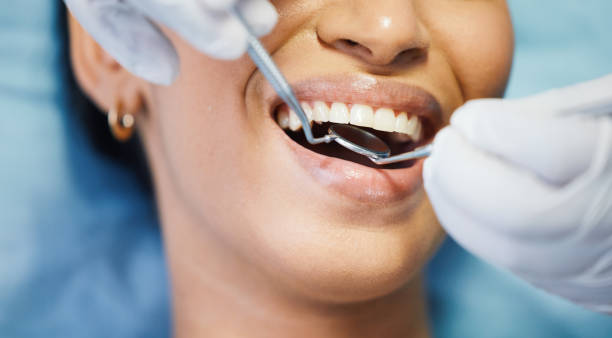 Best Emergency Dental Services for Seniors in St Louis, MI