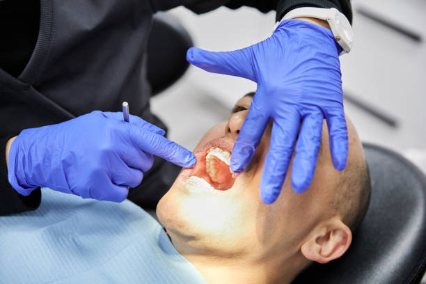 Best Broken or Cracked Tooth Emergency Dentist in St Louis, MI