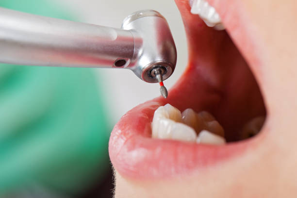 Best Holiday Emergency Dentist in St Louis, MI